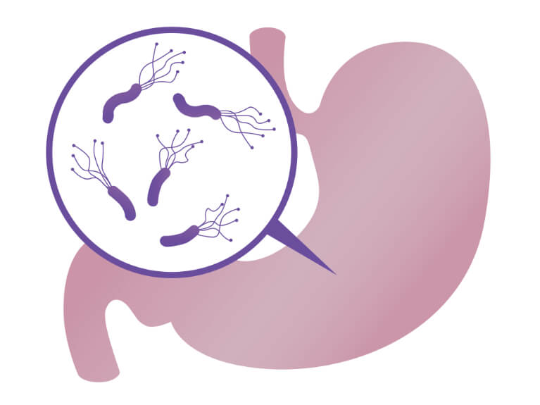 ピロリ菌に感染していると診断を受けたら